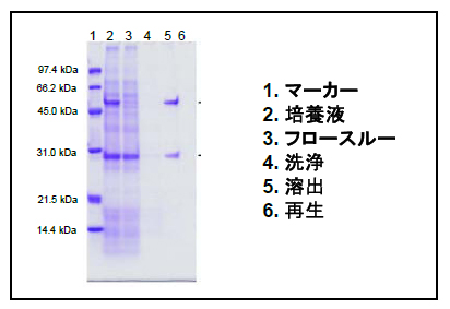 回収液電気泳動結果例の図