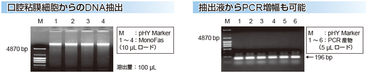 口腔粘膜からのDNA抽出と抽出液からPCR増幅も可能説明図